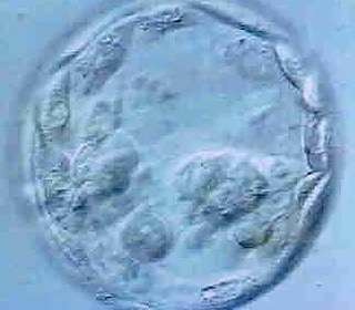 img-blastocyst-culture