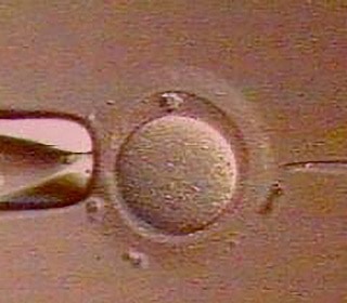 img-intracytoplasmic-sperm-injection